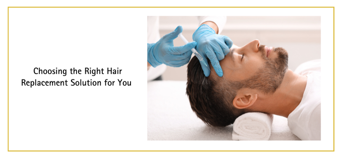 Choosing the Right Hair Replacement Solution for You