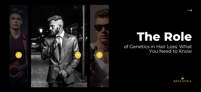The Role of Genetics in Hair Loss: What You Need to Know